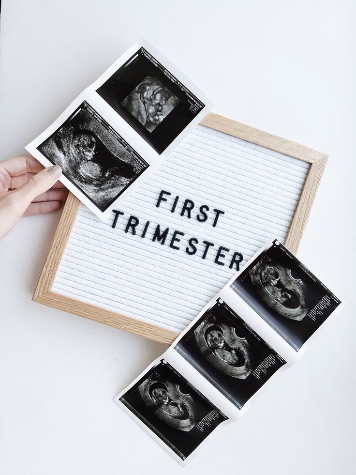 Pregnancy Symptoms no ones talks about (1st trimester&nbsp;edition)